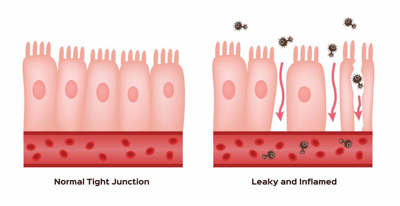 Vitamin D And Ibd Testing Guide Immundiagnostik Inc